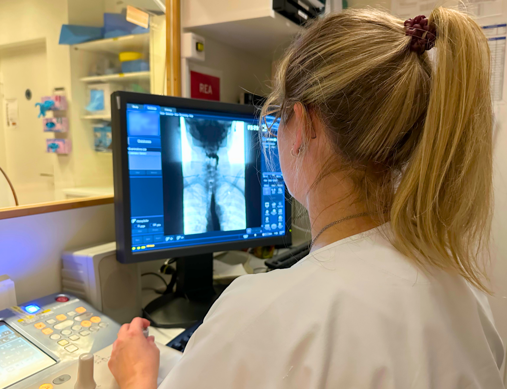 Medizinische Fachkraft betrachtet Röntgenbilder am Computerbildschirm.