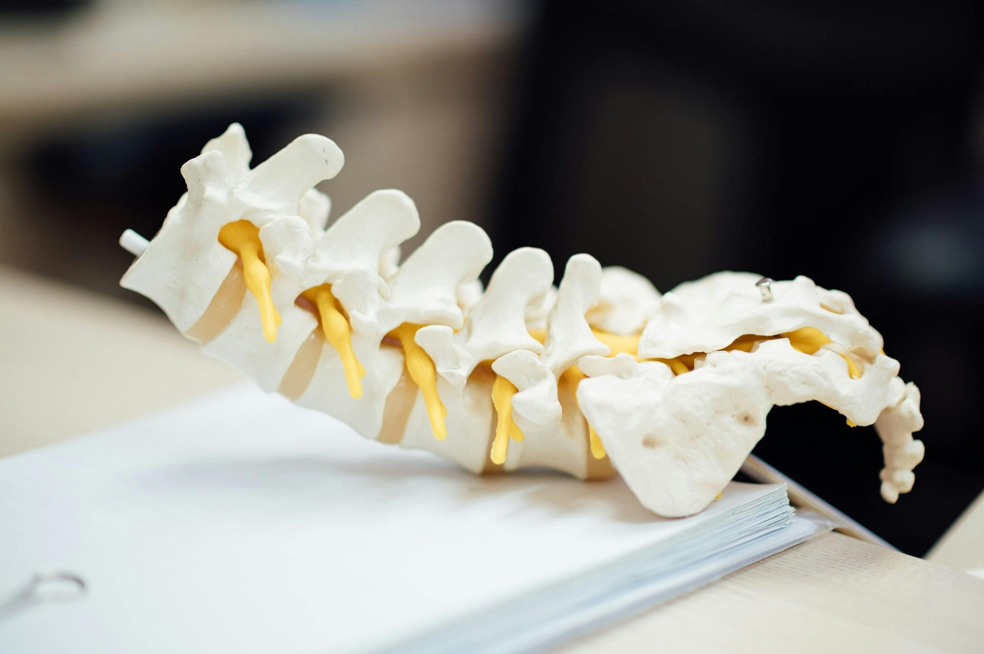 Spinal column model with intervertebral discs on documents.